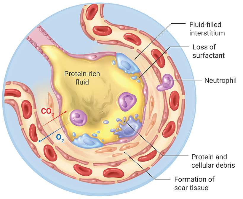Visualizing What COVID 19 Does to Your Body   Visual Capitalist - 34