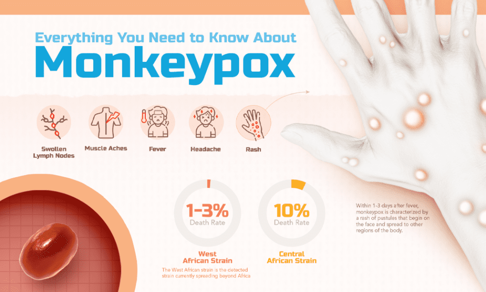 Explainer: What to Know About Monkeypox - Visual Capitalist