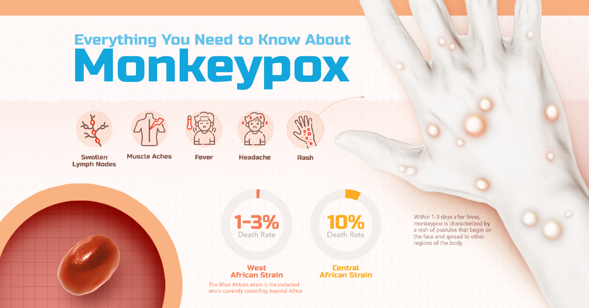 Got rashes? How do you know it's Monkeypox, not something else?